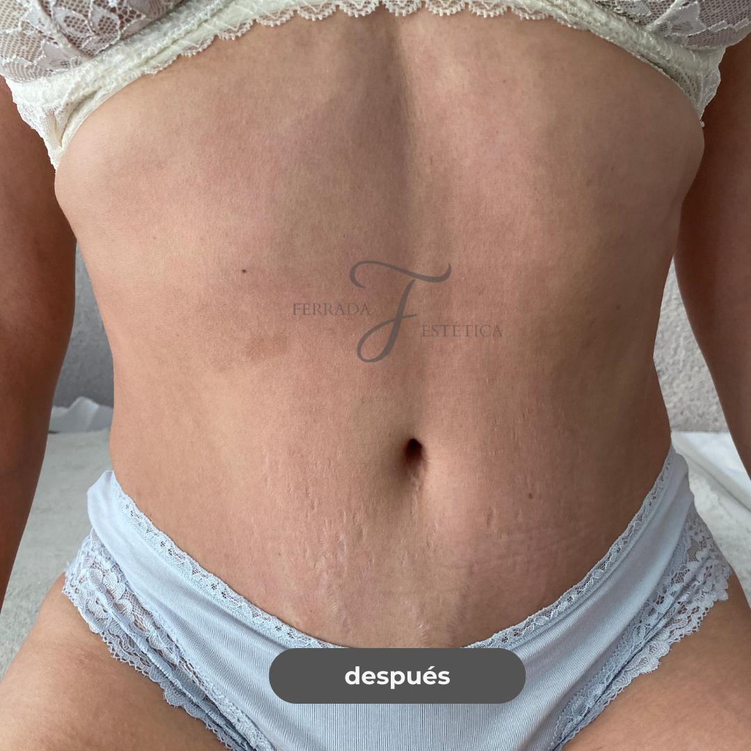 C18